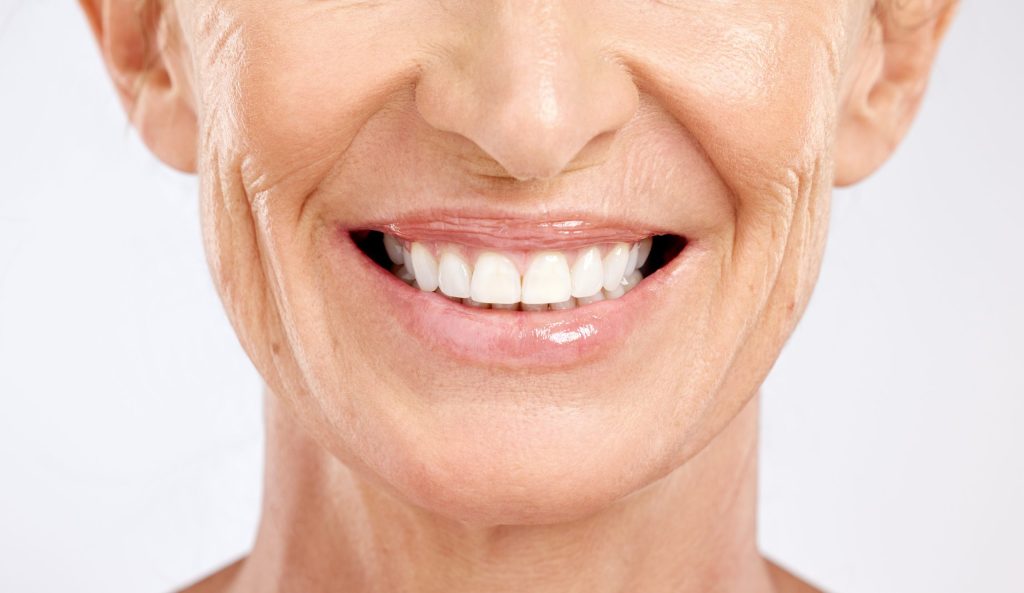 Implantes Dentales